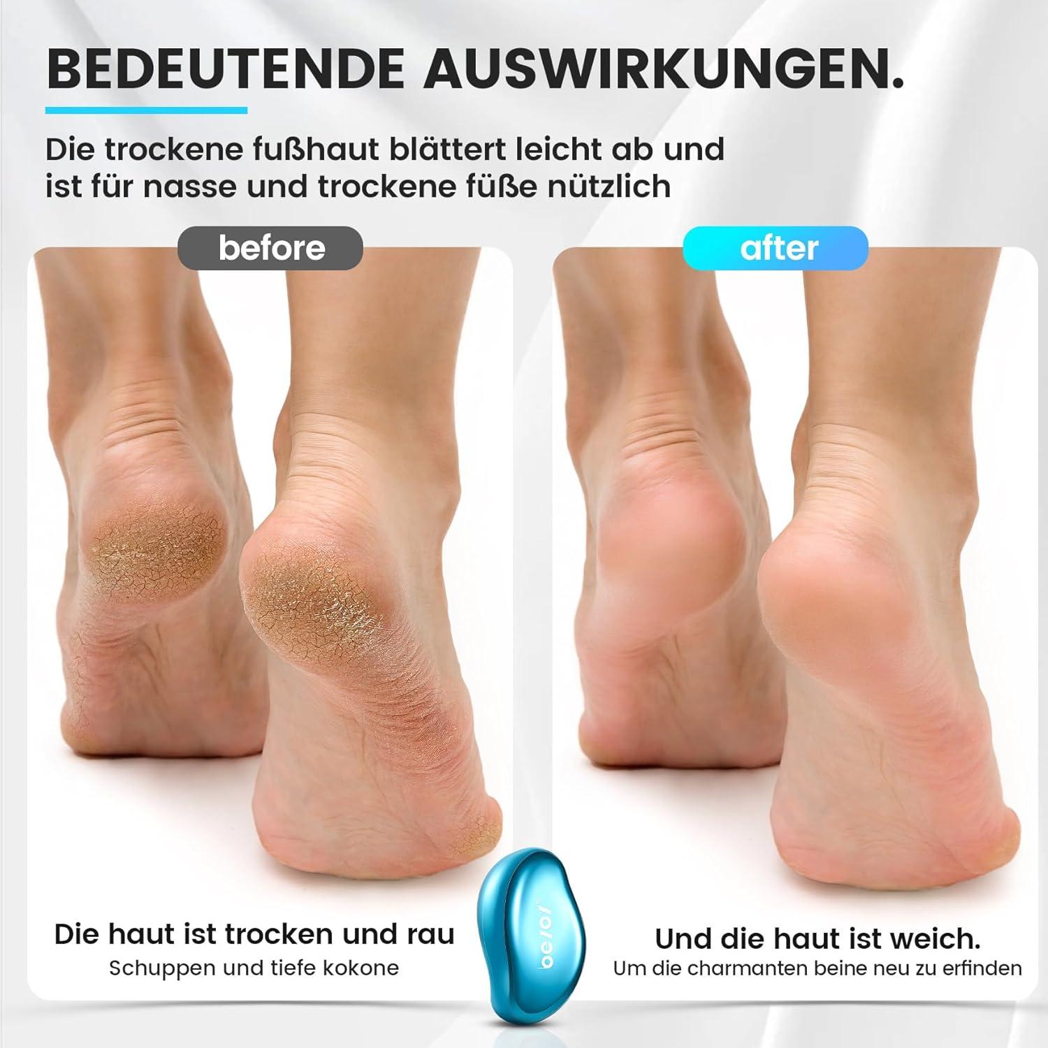 2in1 Nano Glas Hornhautentferner für professionelle Pediküre