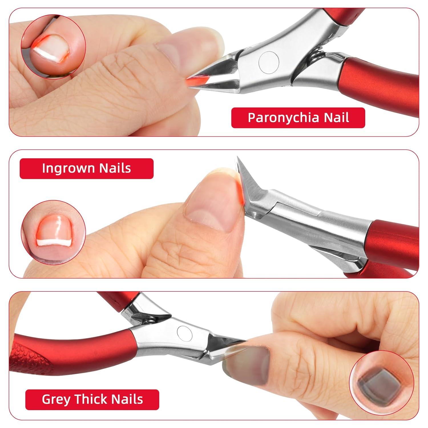 Nagelschere Edelstahl Profi Fußnagelzange Eingewachsene Nägel