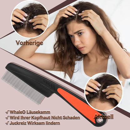 WhaleO 3 Stück Schuppenkamm Set Edelstahl Läusekamm Silikongriff Dandruff Comb