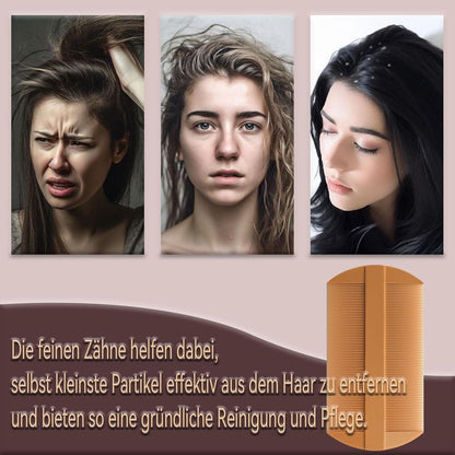 WhaleO 3 Stück Schuppenkamm Set Edelstahl Läusekamm Silikongriff Dandruff Comb