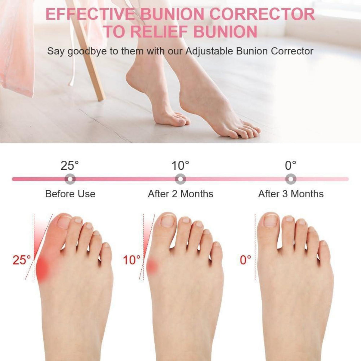Hallux Valgus Korrektur Schiene mit Zehenspreizer, Rosa