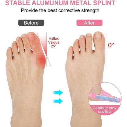 Hallux Valgus Korrektur Schiene mit Zehenspreizer, Rosa