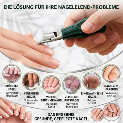 Nagelknipser Fußnägel mit Auffangbehälter & Feilen